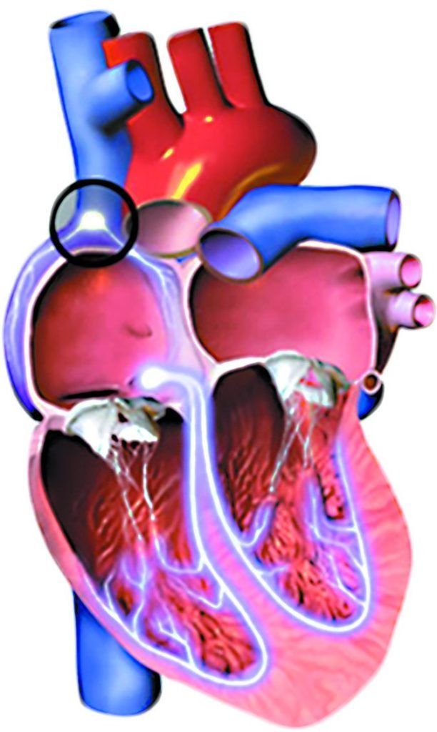 is-a-slow-heart-rate-as-big-a-risk-to-your-health-as-a-fast-one